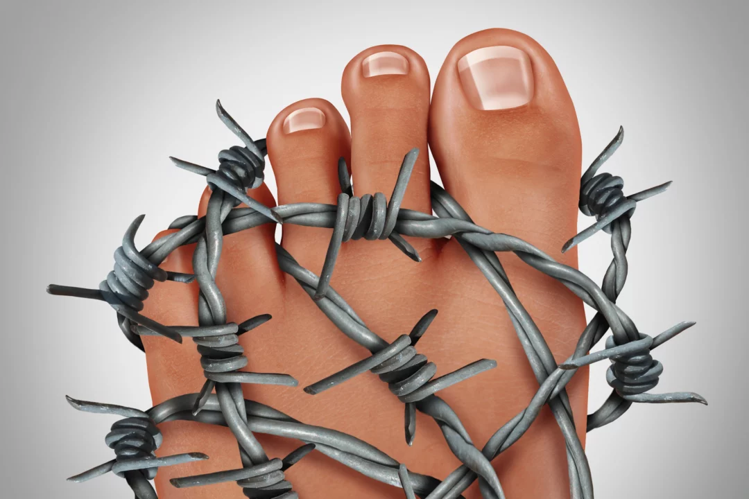 Lidské prsty obtočené ostnatým drátem symbolizující bolest, utrpení a omezení volnosti pohybu.